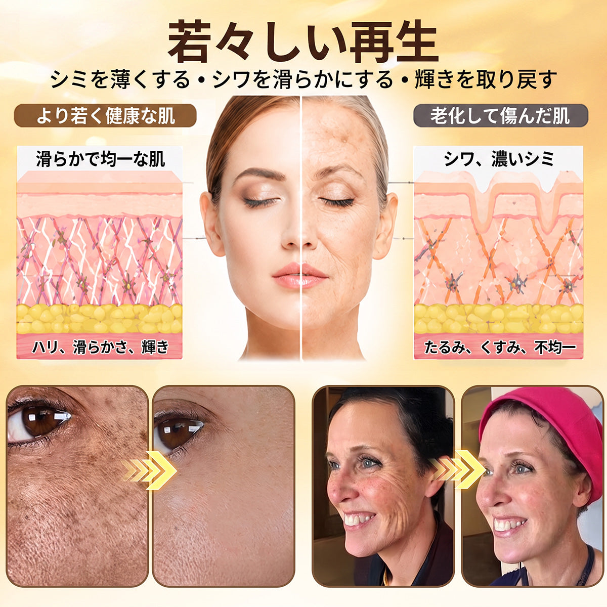 HISKIN®🏆 バストケア ナノマイクロニードルパッチ ふっくらボリューム感・ハリ・弾力をサポート ボルフィリン × エクソソーム × 銅ペプチド配合 先進の美容成分デリバリーテクノロジー採用